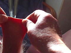 40 minutes - foreskin and scrotum in sunlight